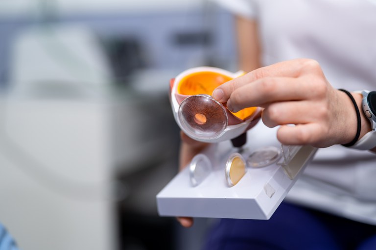 La vida sense 20 diòptries gràcies a la cirurgia refractiva intraocular La vida sense 20 diòptries gràcies a la cirurgia refractiva intraocular