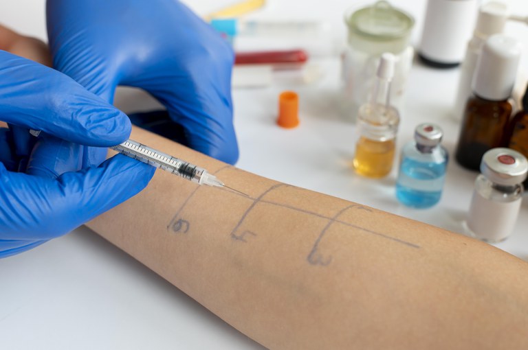 Al·lergologia Al·lergologia CSJ